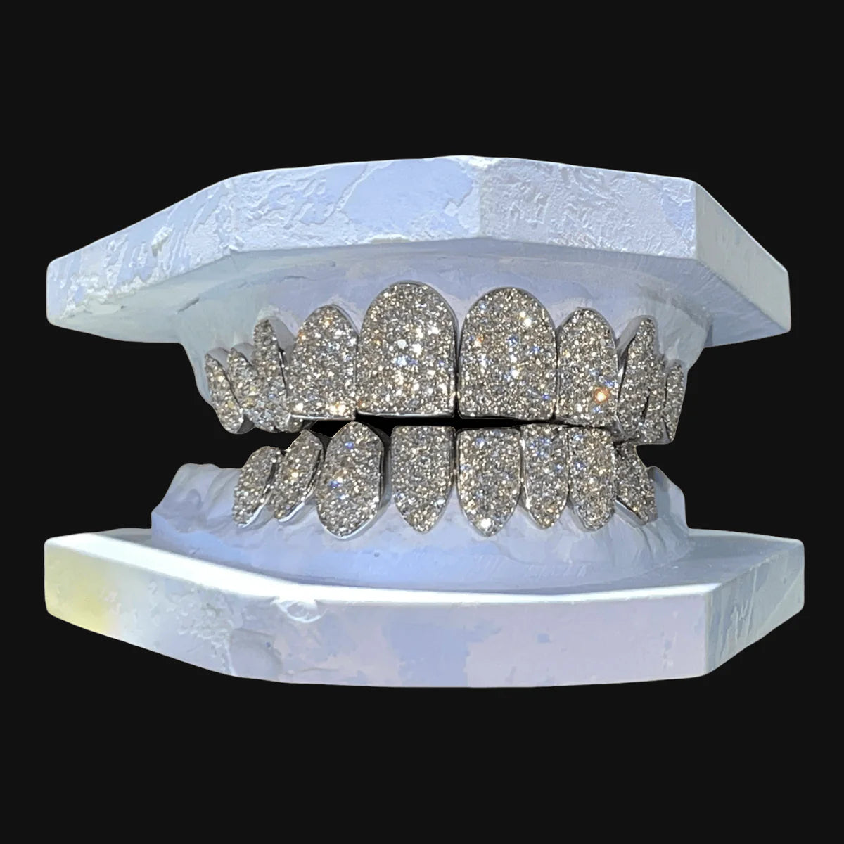Diamond Grillz ($400 per tooth)