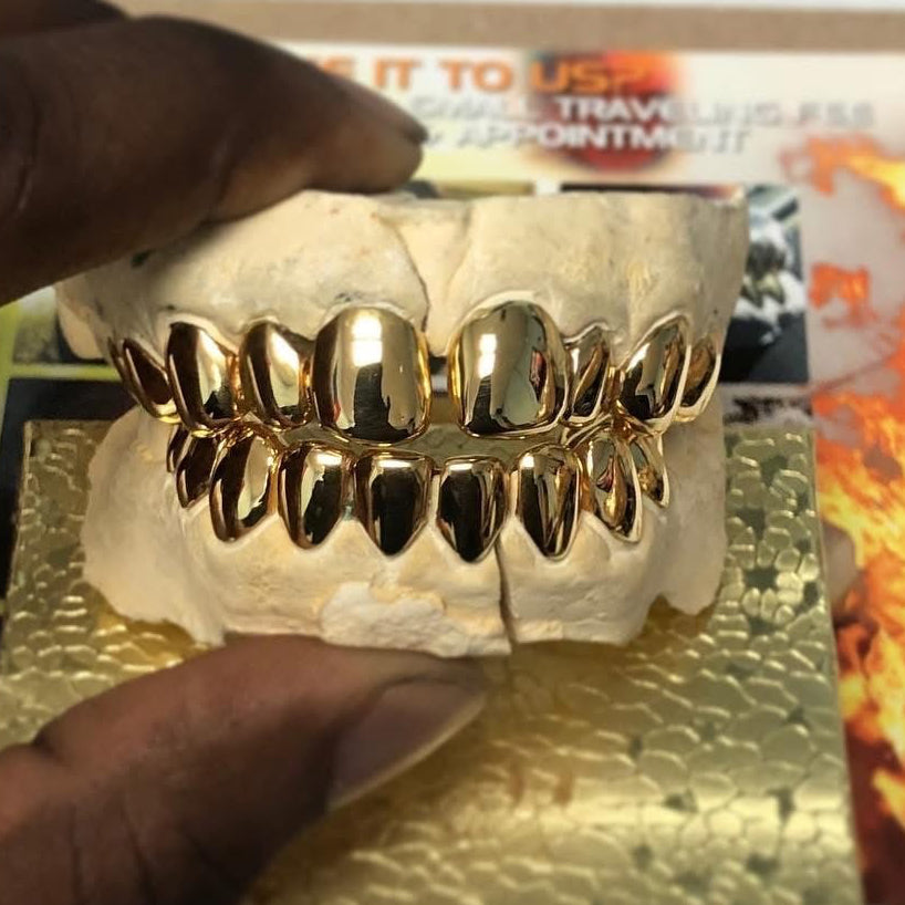 10k Gold Grillz ($180 per tooth)