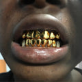 6 on 6 NPG (12 Pack)
