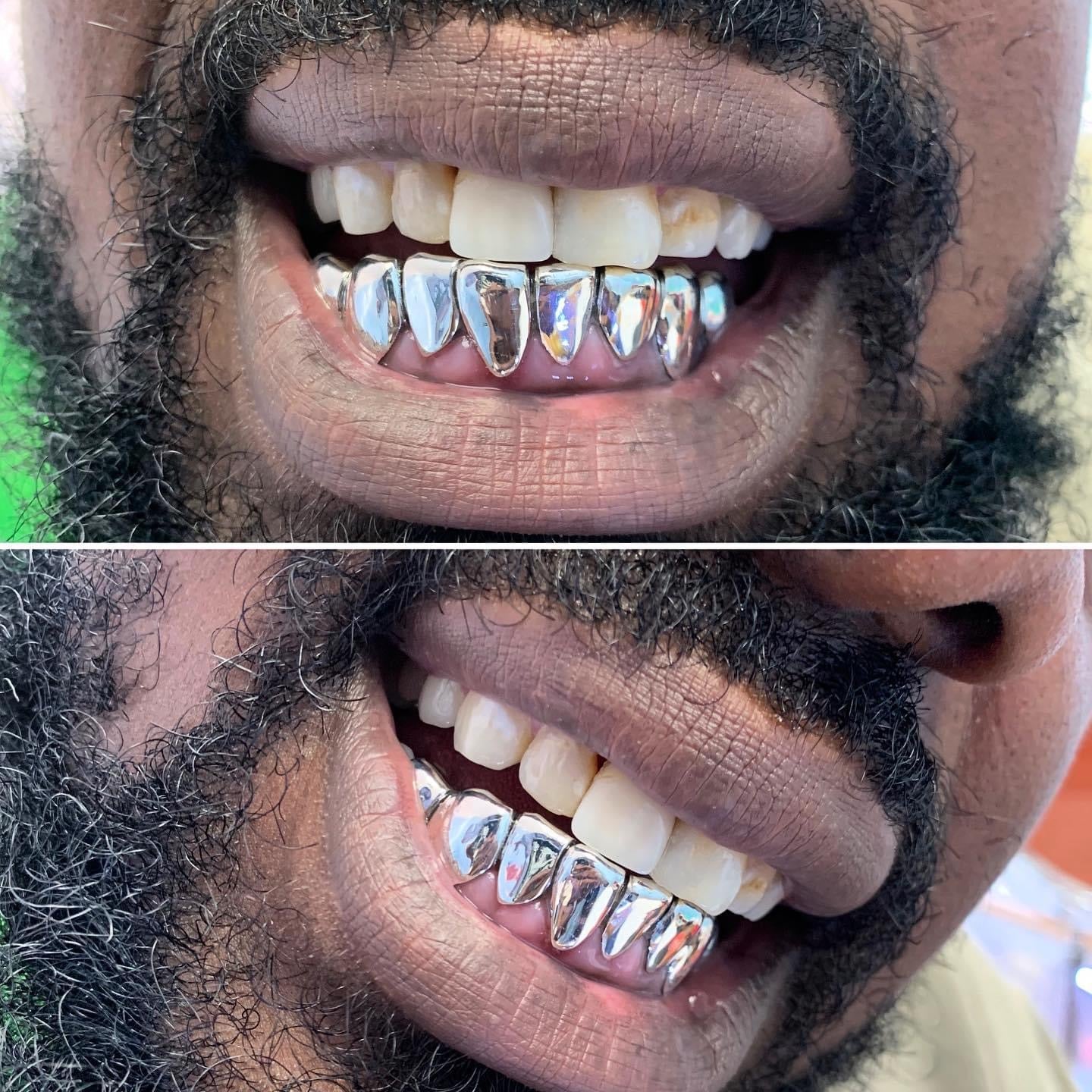 Silver Grillz ($50 a tooth)