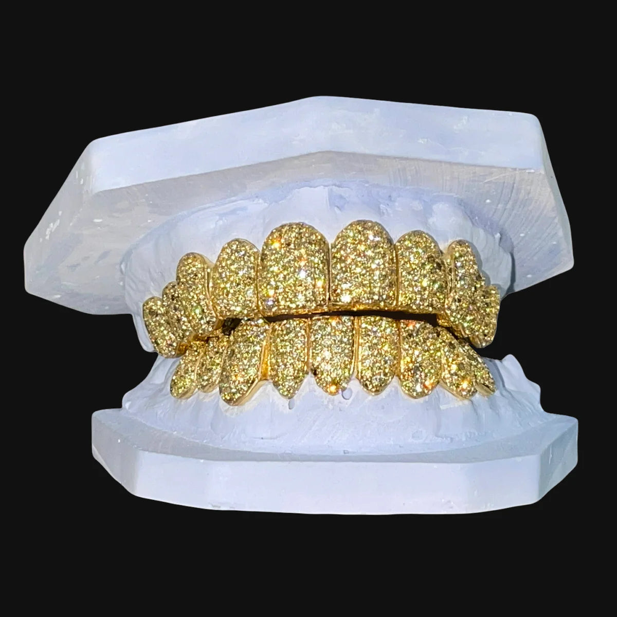 Diamond Grillz ($400 per tooth)
