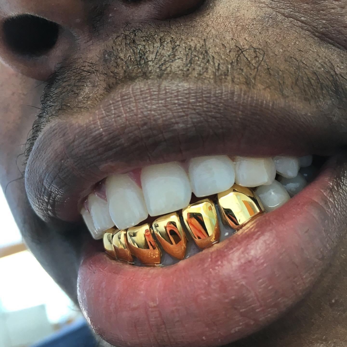 6 bottom or 6 top NPG (6 Pack)