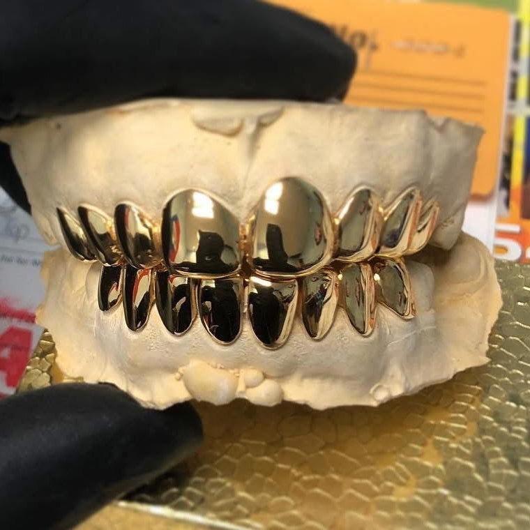 14 Karat Gold ($285 per tooth)
