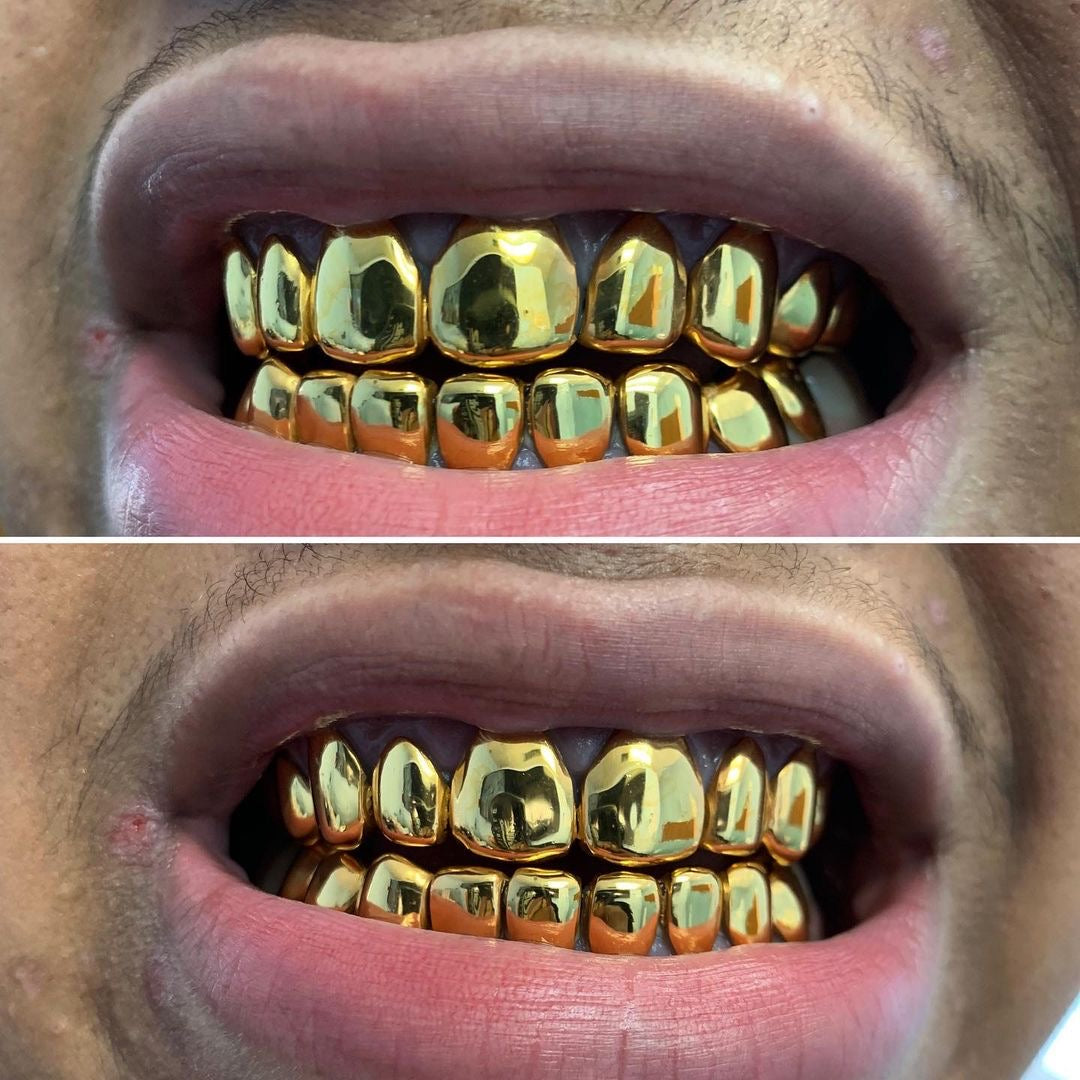 8 on 8 NPG (16 wall)