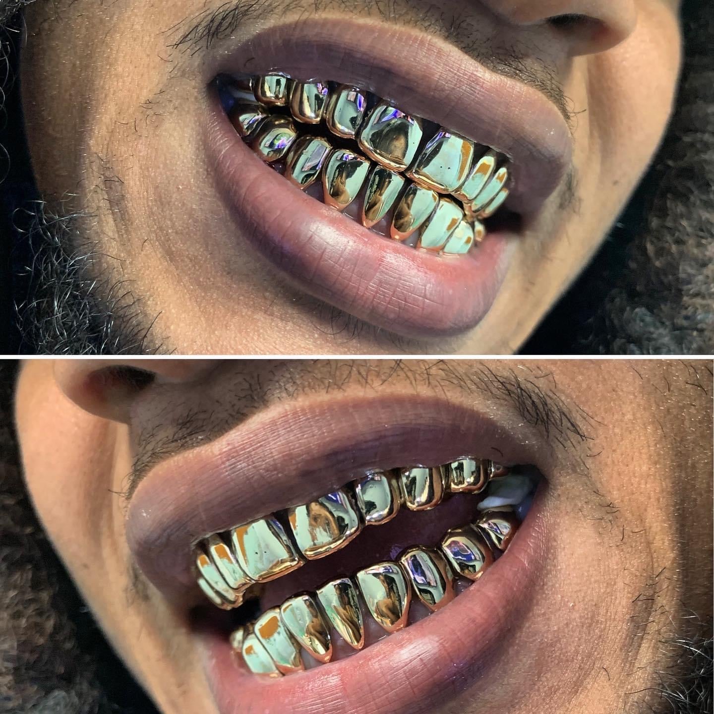 10k Gold Grillz ($180 per tooth)