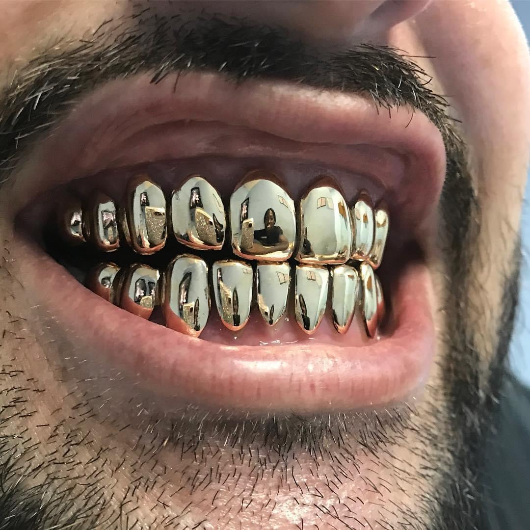 14 Karat Gold ($285 per tooth)