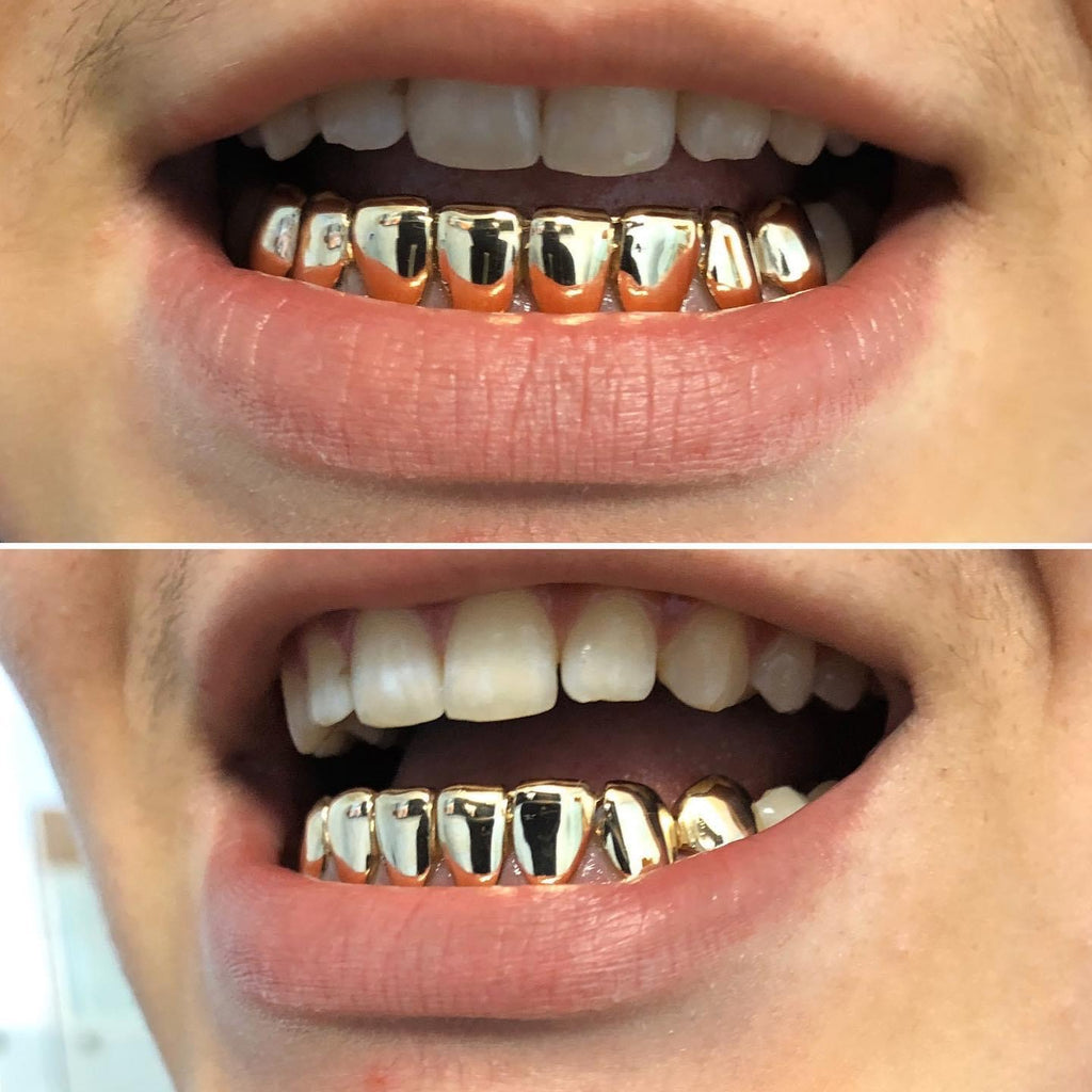 10k Gold Grillz ($180 per tooth)