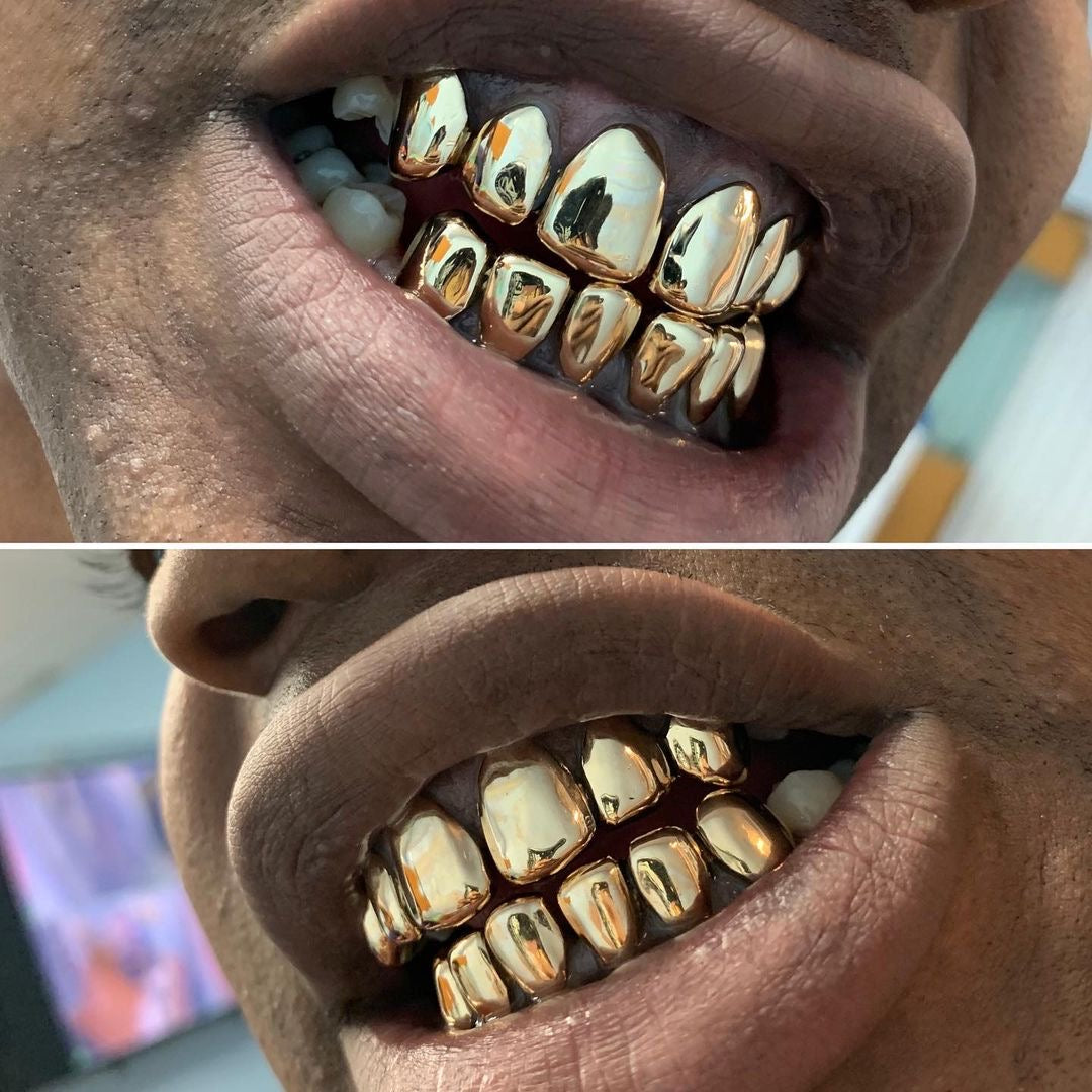 10k Gold Grillz ($180 per tooth)