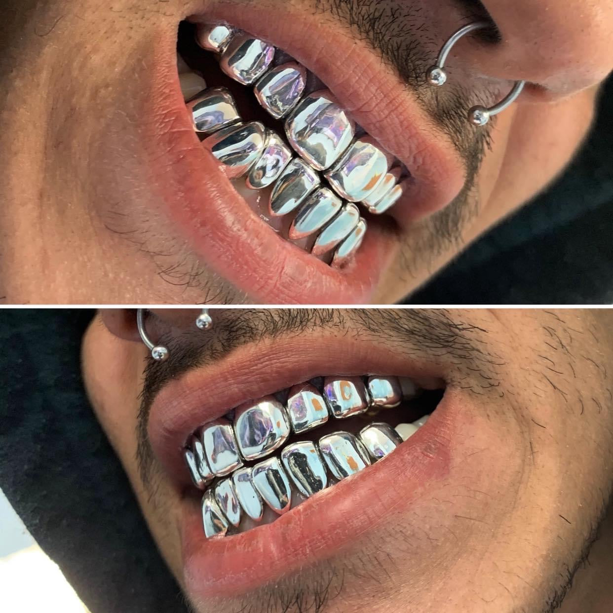 Silver Grillz ($50 a tooth)