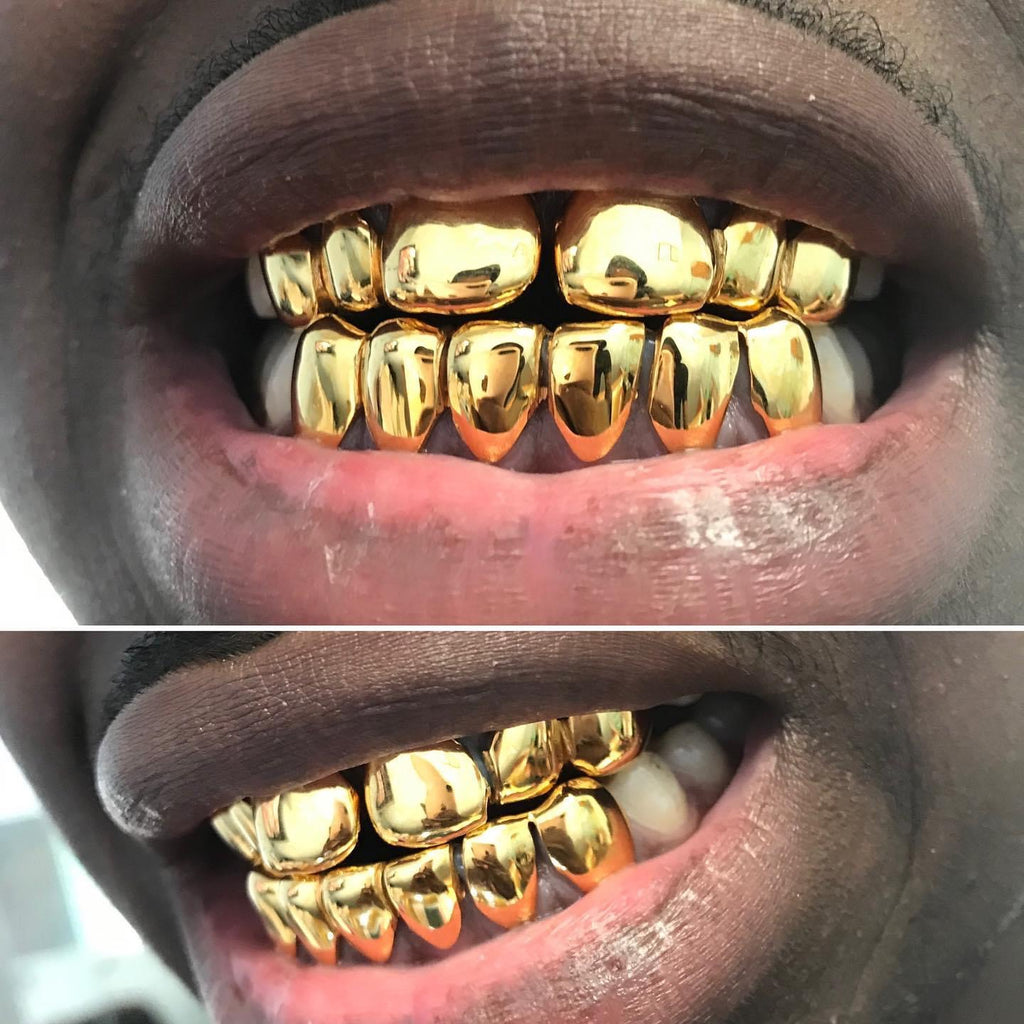 6 on 6 NPG (12 Pack)