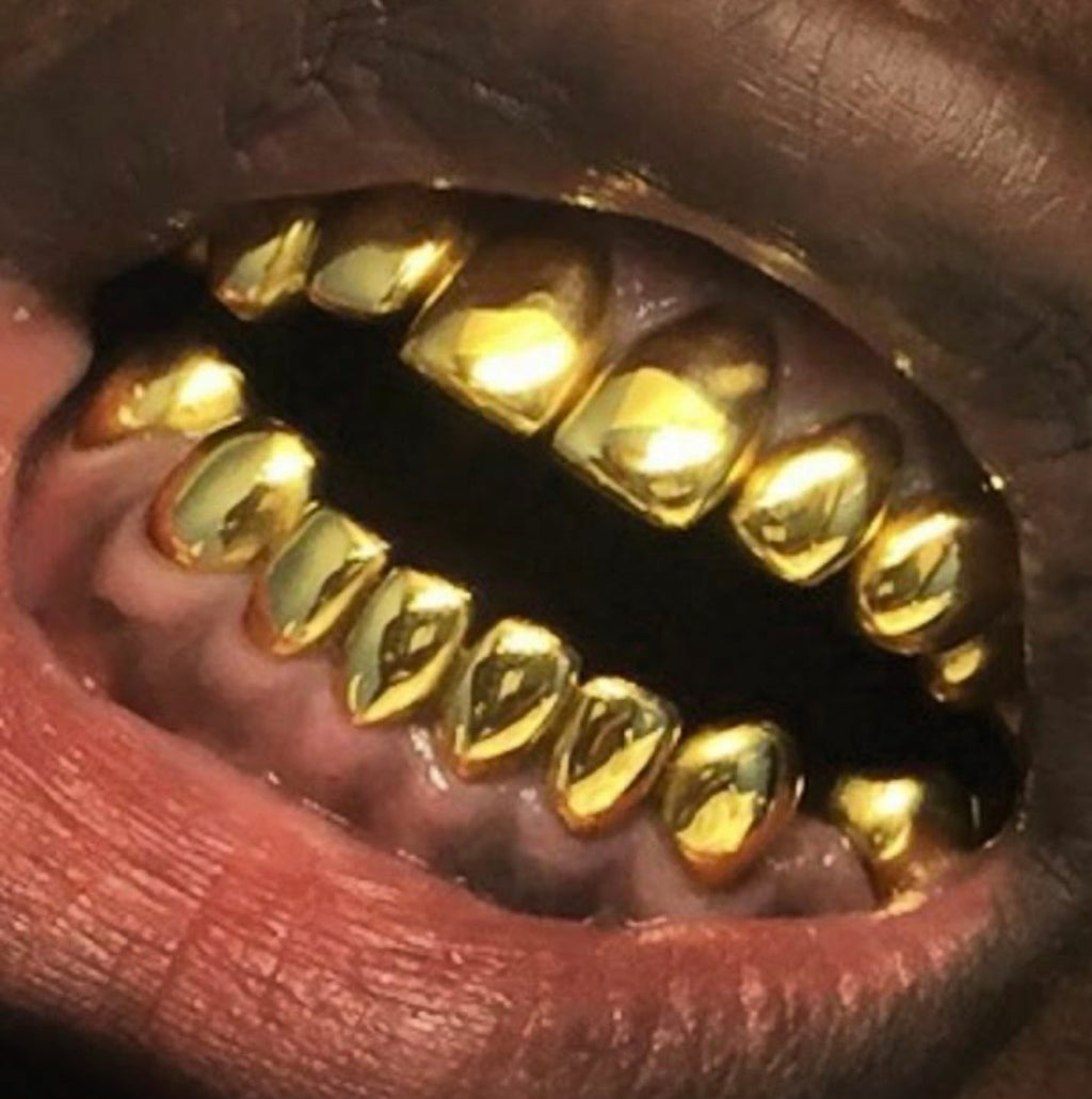 22k Gold (Permanent Crown)