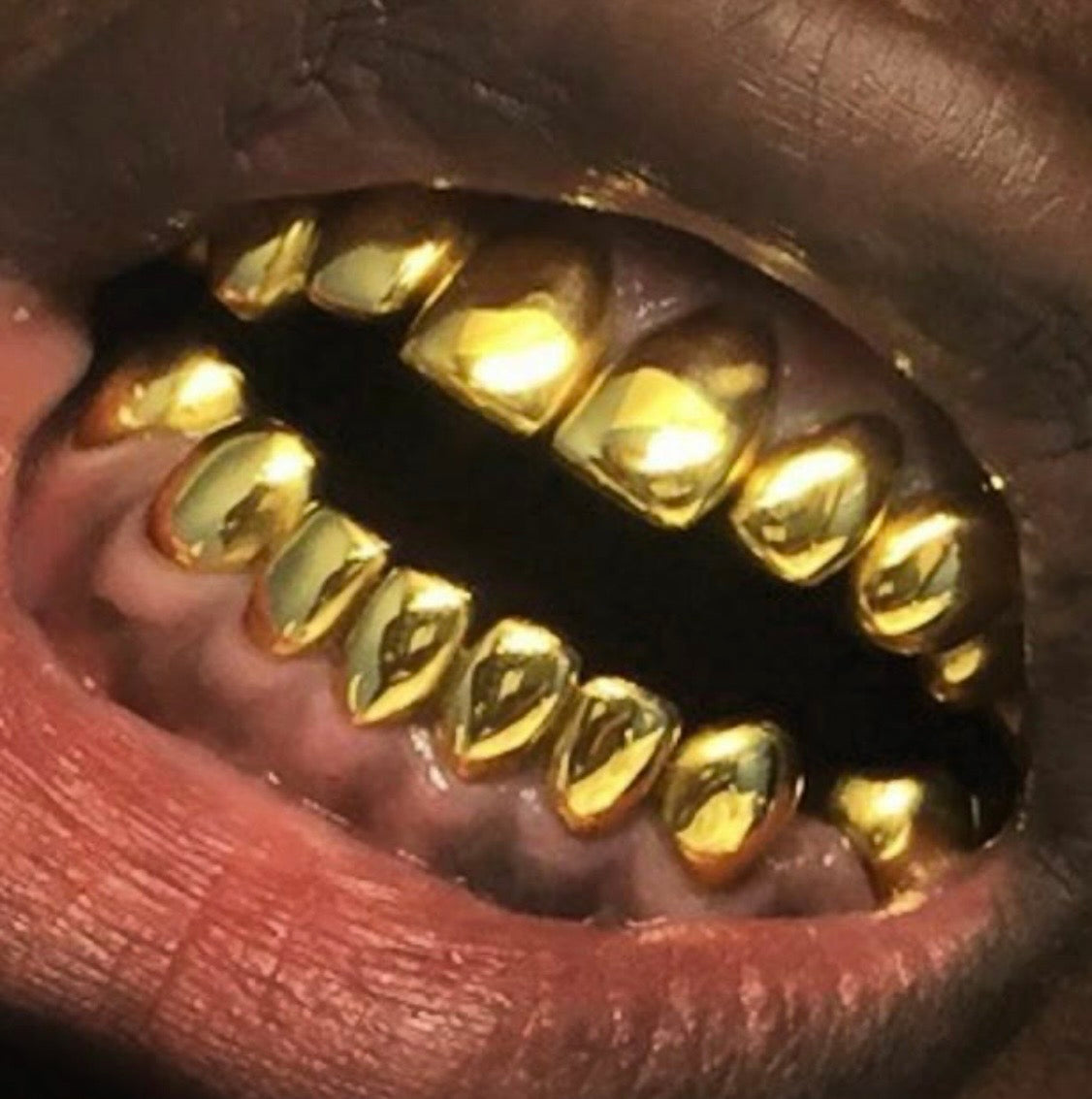 22k Gold (Permanent Crown)