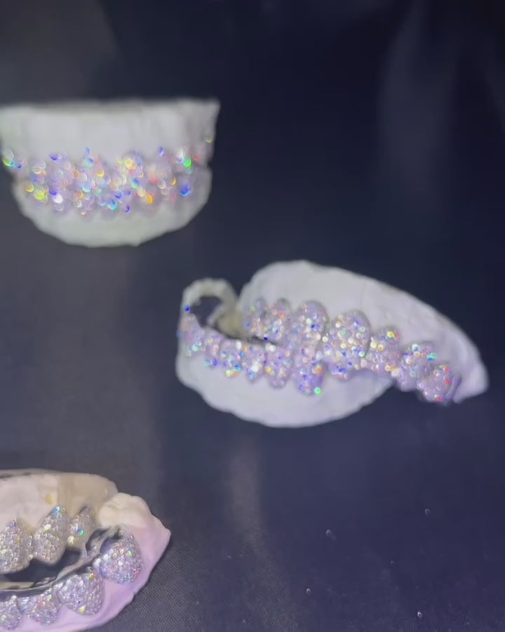 Diamond Grillz ($400 per tooth)